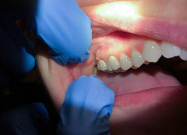 Best Emergency Treatment for Oral Infections in Maili, HI